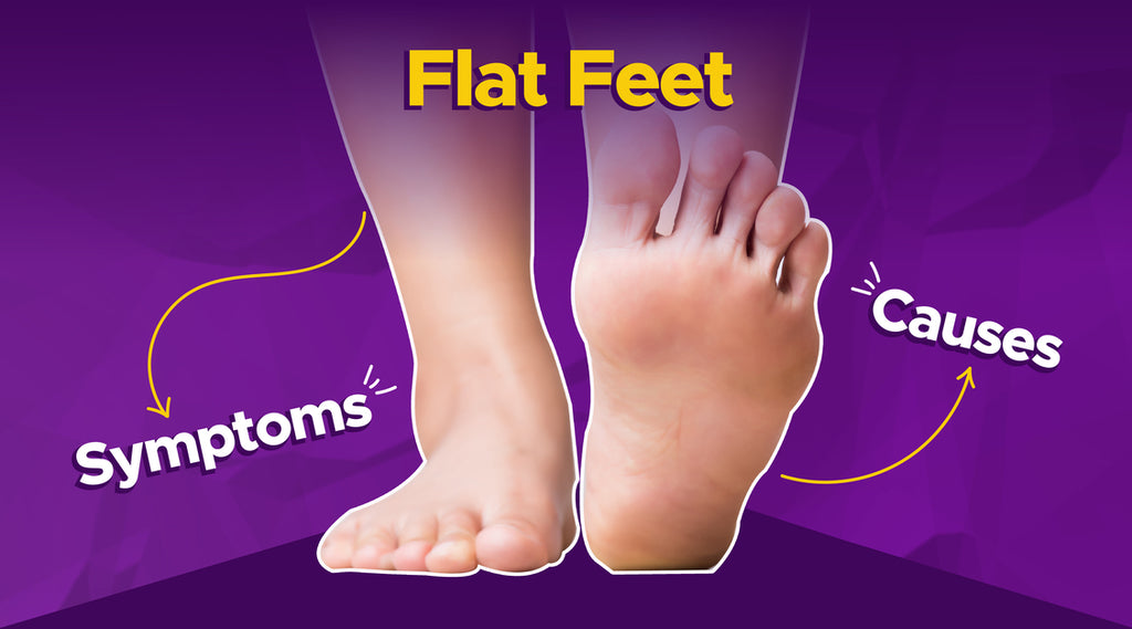 Flat feet: Causes and Symptoms