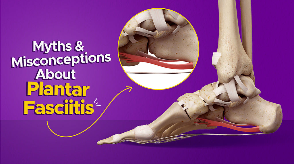 Myths and Misconceptions about Plantar Fasciitis