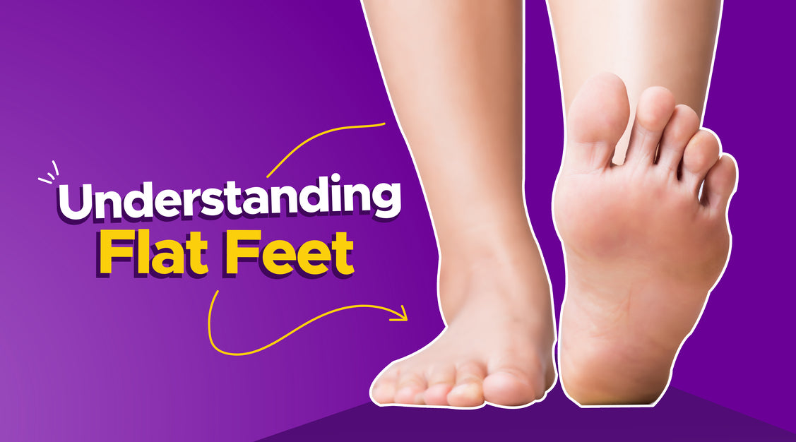 Understanding Flat Feet - MyFrido