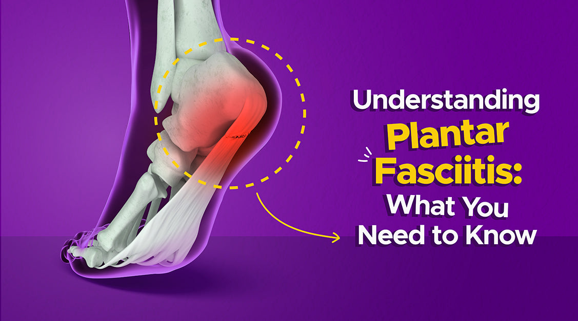 Understanding Plantar Fasciitis: What You Need to Know