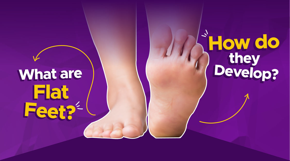 What are flat feet and how do they develop?