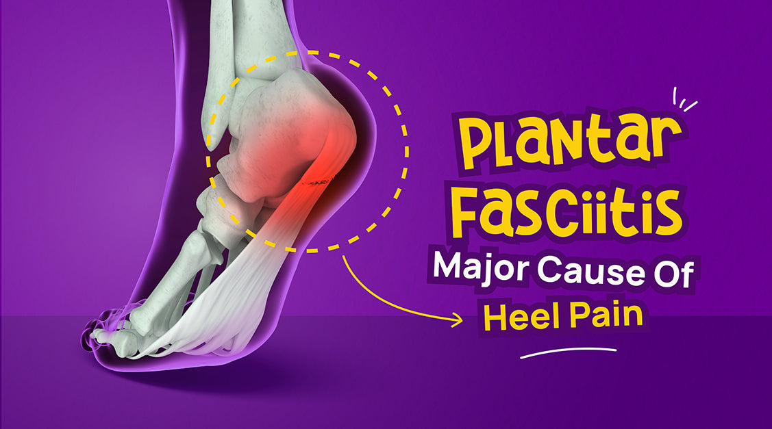 Plantar Fasciitis - Major Cause Of Heel Pain