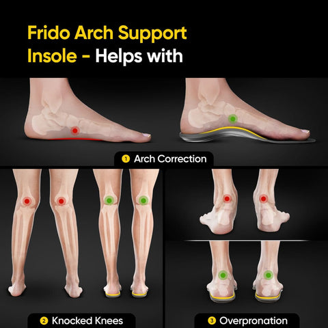 AC - Frido Arch Support Insoles Rigid + Semi Rigid Combo